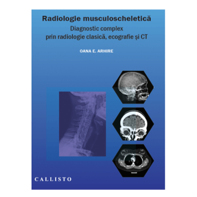 Radiologie musculo-scheletica, diagnostic complex prin radiologie clasica, ecografie si CT
